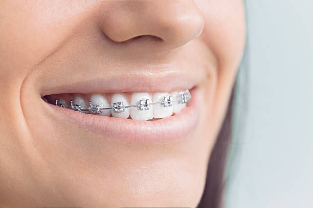 Best Traditional Braces  in Shandon, CA